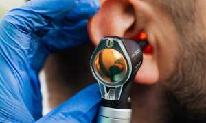 Otorino visita orecchio