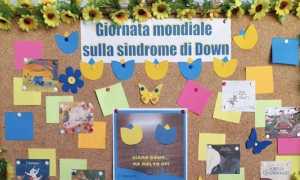 cameri sindrome down