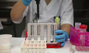 covid 19 5752221 640