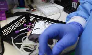 donazione sangue avis