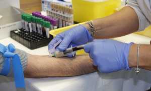 infermiere dottore prelievo sangue