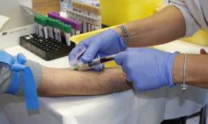 prelievo sangue
