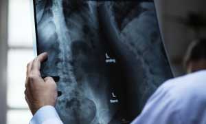 radiologia