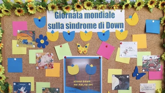 cameri sindrome down